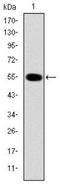 Interleukin 1 Receptor Associated Kinase 4 antibody, NBP2-37575, Novus Biologicals, Western Blot image 