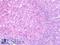 C-C Motif Chemokine Receptor 7 antibody, LS-A4254, Lifespan Biosciences, Immunohistochemistry frozen image 