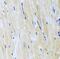 Inositol-Trisphosphate 3-Kinase B antibody, FNab04423, FineTest, Immunohistochemistry paraffin image 