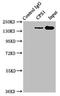 Carbamoyl-Phosphate Synthase 1 antibody, LS-C669845, Lifespan Biosciences, Immunoprecipitation image 