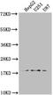 ADP Ribosylation Factor Like GTPase 2 Binding Protein antibody, CSB-PA897097HA01HU, Cusabio, Western Blot image 