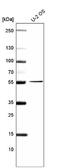 Preferentially Expressed Antigen In Melanoma antibody, NBP2-61148, Novus Biologicals, Western Blot image 