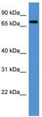 Protein angel homolog 1 antibody, TA333522, Origene, Western Blot image 