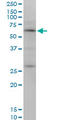 Otopetrin 2 antibody, LS-C139281, Lifespan Biosciences, Western Blot image 