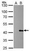 Proline And Serine Rich Coiled-Coil 1 antibody, GTX628833, GeneTex, Western Blot image 