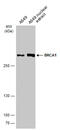 BRCA1 DNA Repair Associated antibody, GTX100720, GeneTex, Western Blot image 