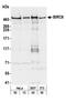 Baculoviral IAP Repeat Containing 6 antibody, NB300-264, Novus Biologicals, Western Blot image 