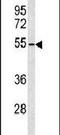 ADAM Like Decysin 1 antibody, PA5-26128, Invitrogen Antibodies, Western Blot image 