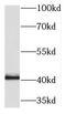 Protein Kinase X-Linked antibody, FNab06788, FineTest, Western Blot image 