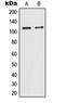 Tripartite Motif Containing 24 antibody, orb214831, Biorbyt, Western Blot image 