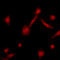 G Protein-Coupled Receptor Kinase 2 antibody, LS-C351803, Lifespan Biosciences, Immunofluorescence image 