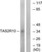 Taste receptor type 2 member 10 antibody, PA5-39708, Invitrogen Antibodies, Western Blot image 