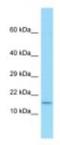 Sperm Associated Antigen 11A antibody, NBP1-98296, Novus Biologicals, Western Blot image 