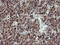 TRAF Interacting Protein antibody, M07953, Boster Biological Technology, Immunohistochemistry paraffin image 