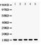 Profilin 1 antibody, LS-C357501, Lifespan Biosciences, Western Blot image 