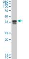 Poly(RC) Binding Protein 2 antibody, H00005094-M08, Novus Biologicals, Western Blot image 