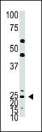 Achaete-Scute Family BHLH Transcription Factor 1 antibody, 60-921, ProSci, Western Blot image 