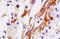 Collagen Type V Alpha 1 Chain antibody, 251202, Abbiotec, Immunohistochemistry paraffin image 