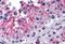 Karyopherin Subunit Alpha 5 antibody, A09441, Boster Biological Technology, Immunohistochemistry frozen image 