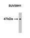 Histone-lysine N-methyltransferase SUV39H1 antibody, AM11036PU-N, Origene, Western Blot image 