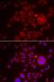 Serine Peptidase Inhibitor, Kunitz Type 1 antibody, LS-C334696, Lifespan Biosciences, Immunofluorescence image 