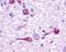 Pyroglutamylated RFamide Peptide Receptor antibody, NLS1922, Novus Biologicals, Immunohistochemistry frozen image 