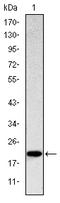 Killer Cell Lectin Like Receptor D1 antibody, A03257-1, Boster Biological Technology, Western Blot image 