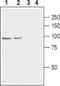 Calcium Voltage-Gated Channel Auxiliary Subunit Beta 2 antibody, PA5-77344, Invitrogen Antibodies, Western Blot image 