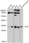 Uridine-Cytidine Kinase 2 antibody, GTX64911, GeneTex, Western Blot image 