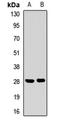 22 kDa pancornulin antibody, LS-C668667, Lifespan Biosciences, Western Blot image 
