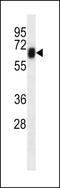 Receptor Like Tyrosine Kinase antibody, LS-C162823, Lifespan Biosciences, Western Blot image 