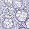 Oligodendrocyte Myelin Glycoprotein antibody, PA5-52972, Invitrogen Antibodies, Immunohistochemistry frozen image 