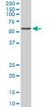 Calcium Voltage-Gated Channel Auxiliary Subunit Beta 2 antibody, LS-B14311, Lifespan Biosciences, Western Blot image 