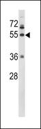 Fibrinogen Gamma Chain antibody, 62-341, ProSci, Western Blot image 