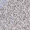 TCF3 Fusion Partner antibody, NBP1-89106, Novus Biologicals, Immunohistochemistry paraffin image 