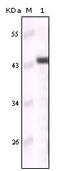 Keratin 5 antibody, STJ97989, St John