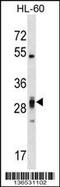 Pleckstrin Homology And FYVE Domain Containing 2 antibody, 58-742, ProSci, Western Blot image 