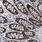 Mitochondrial RRNA Methyltransferase 1 antibody, PA5-54466, Invitrogen Antibodies, Immunohistochemistry frozen image 
