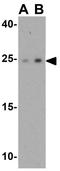 Spermatogenesis Associated 19 antibody, GTX32045, GeneTex, Western Blot image 