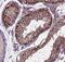 Apolipoprotein B MRNA Editing Enzyme Catalytic Polypeptide Like 4 antibody, FNab00497, FineTest, Immunohistochemistry paraffin image 