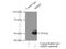 Arrestin Beta 2 antibody, 10171-1-AP, Proteintech Group, Immunoprecipitation image 