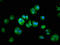 Coatomer Protein Complex Subunit Gamma 2 antibody, LS-C673698, Lifespan Biosciences, Immunofluorescence image 
