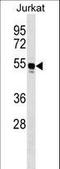 Tryptophanyl-TRNA Synthetase antibody, LS-C157360, Lifespan Biosciences, Western Blot image 