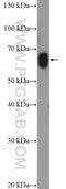 Zinc Finger Protein 470 antibody, 26134-1-AP, Proteintech Group, Western Blot image 