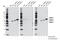 Calcium/Calmodulin Dependent Protein Kinase II Beta antibody, 12716S, Cell Signaling Technology, Western Blot image 