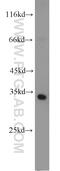 Phosducin Like 2 antibody, 17407-1-AP, Proteintech Group, Western Blot image 