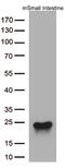 Cytoglobin antibody, M01197, Boster Biological Technology, Western Blot image 