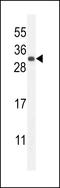 Fibroblast Growth Factor 9 antibody, LS-C166140, Lifespan Biosciences, Western Blot image 