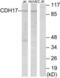 Cadherin 17 antibody, LS-C119409, Lifespan Biosciences, Western Blot image 