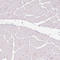 Anillin Actin Binding Protein antibody, AMAb90662, Atlas Antibodies, Immunohistochemistry paraffin image 